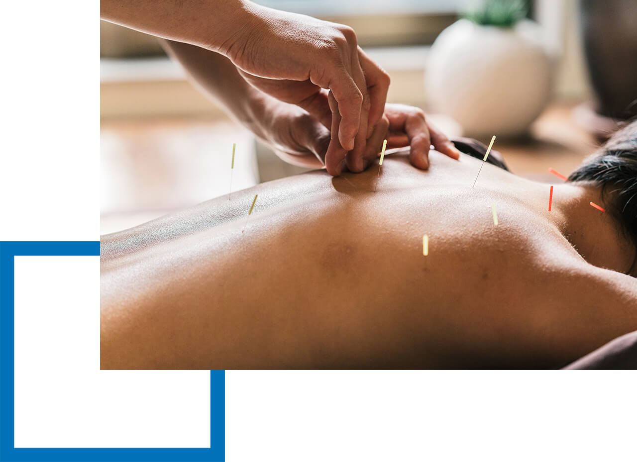 Berufshaftpflicht für Heilpraktiker Patientin erhält Akupunktur vom versicherten Heilpraktiker